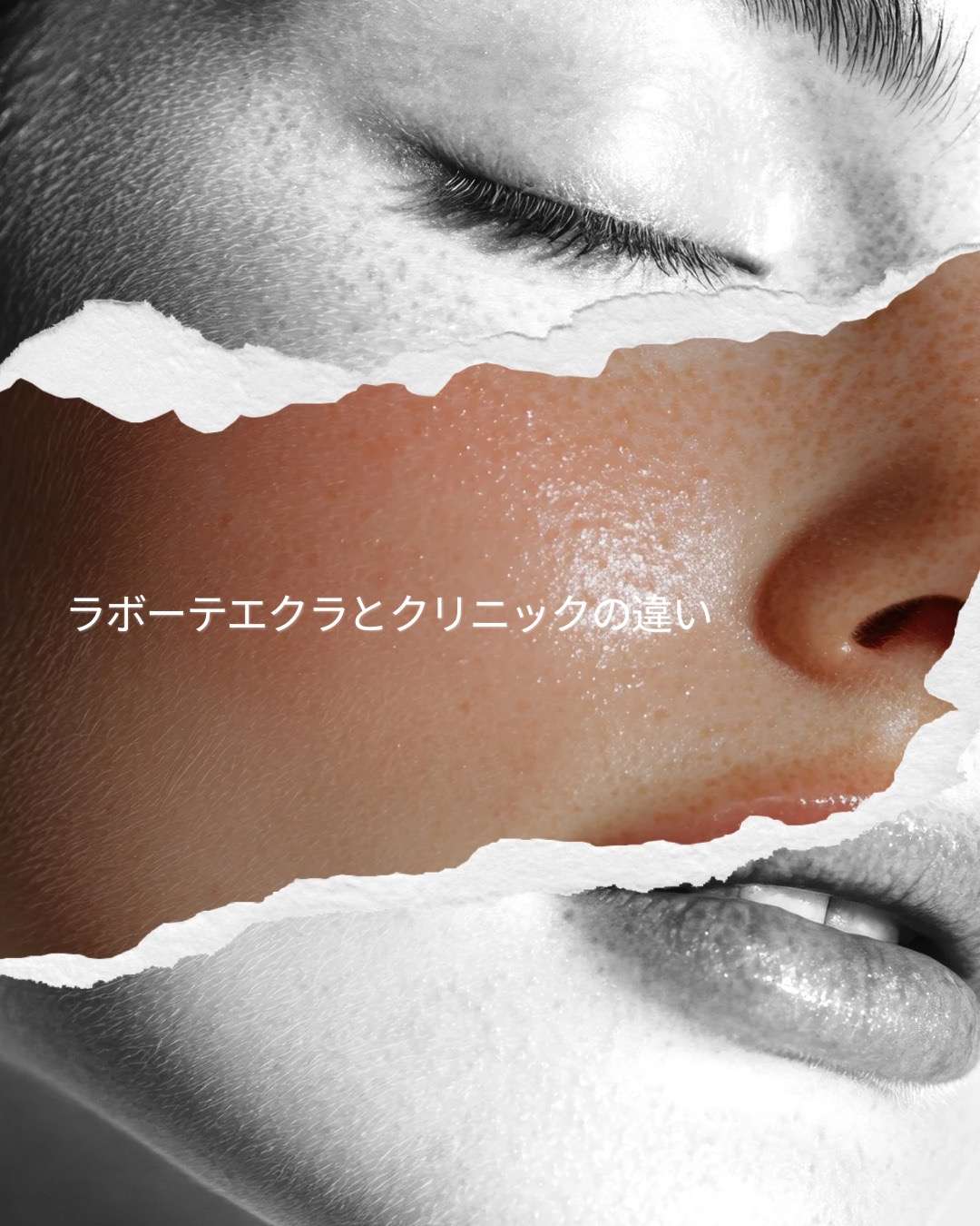 大阪・本町でシミや肝斑に悩むあなたへ  美容医療の時代でも、“育てながら改善する”という美しさの選び方」